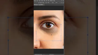 Remove Dark Circles Naturally | 1 - Minute Photoshop #shorts