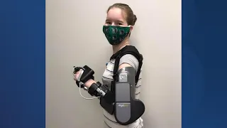 ‘Watch out world, here I come’: Deserae Turner gets robotic arm