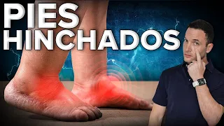 🦶¿Tienes los pies hinchados? puede ser MORTAL Y NO LO SABIAS💀 #retenciondeliquidos