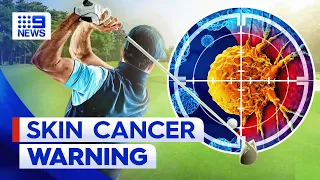 Amateur golfers twice as likely to get skin cancer | 9 News Australia