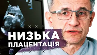 Низька плацентація при вагітності: симптоми, чим загрожує і як лікувати