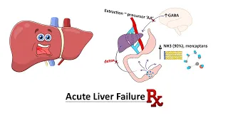 Acute Liver Failure Management