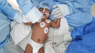 Baby Waking After Surgery