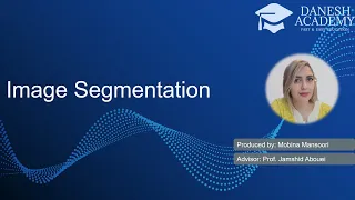 Image Segmentation: A Simple Guide