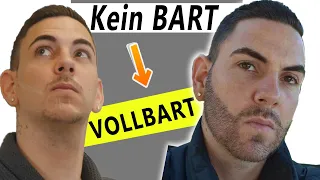 Bart Haartransplantation Deutschland Vorher & Nachher!