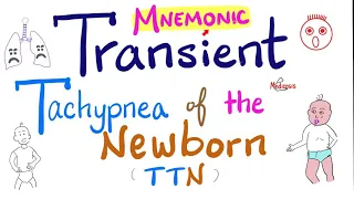 Transient Tachypnea of the Newborn (TTN) 👶 | The F Mnemonic