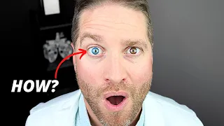 Heterochromia: Different-Colored Eyes - How Does This Happen?