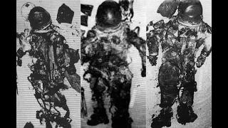 Apollo 1 dead bodies