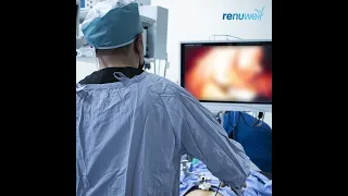 Sabes que es la cirugía laparoscópica o de mínima invasión?