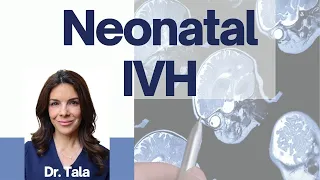 Everything you need to know about Intraventricular Hemorrhage (IVH) - Tala Talks NICU