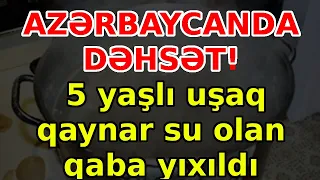 AZƏRBAYCANDA DƏHSƏT! 5 yaşlı uşaq qaynar su olan qaba yıxıldı, xəbərlər, son xeberler, bugun