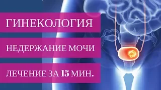 ЭФФЕКТИВНОЕ ЛЕЧЕНИЕ стрессового недержания мочи ЗА 15 МИНУТ. Система TVT-O!