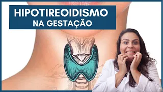 Hipotireoidismo na gestação | Dra. Maíra de La Rocque