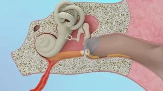 Clogged Ear Due to Ear Infection or Eustachian Tube Dysfunction