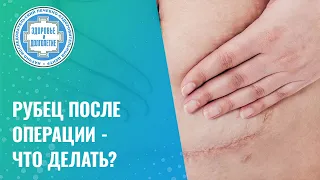 🙋🩹  Рубец после операции - что делать?