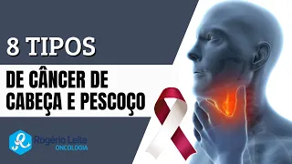 8 Tipos de câncer de cabeça e pescoço