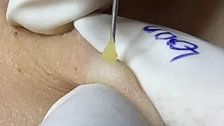 Satisfying With Loan Nguyen Spa Video #007