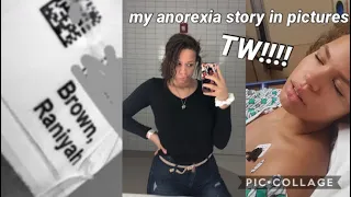 my anorexia story: TW