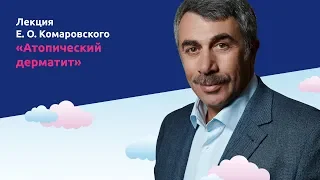 Атопический дерматит - Доктор Комаровский