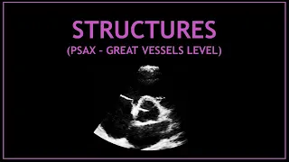 Cardiac STRUCTURES! - Echocardiography (Great vessels view)