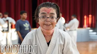 The 'Karate' Teen With Butterfly Skin | BORN DIFFERENT