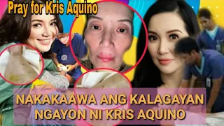 JUST IN | ITO NA PALA ANG NAKAKALUNGKOT NA KALAGAYAN NGAYON NI KRIS AQUINO