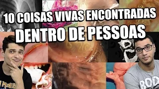 10 COISAS VIVAS ENCONTRADAS DENTRO DE PESSOAS