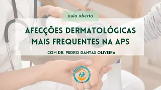 Afecções Dermatológicas mais Frequentes na APS