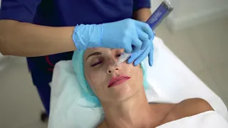 MicroNeedling for Acne Scars - Dermapen ® Treatment  II Amwaj Polyclinic - Medical & Aesthetics