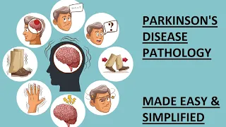 Parkinson's Disease Patients - Parkinson's Disease Treatment - Parkinson's Disease Symptoms