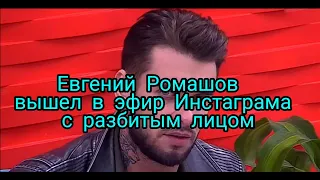 Дом 2 Раньше эфира 9 марта  2022 Евгений Ромашов вышел в эфир Инстаграма с разбитым лицом.