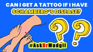 CAN I GET A TATTOO IF I HAVE SCHAMBERG’S DISEASE?