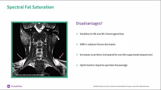 fat suppression webinar replay.mp4