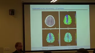 Multimodal Neuromonitoring after SAH - Moscow 2017 Stefan Wolf
