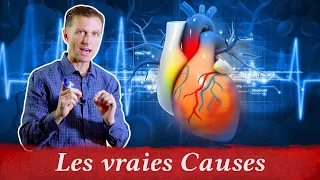 Les 7 causes de l'arythmie cardiaque  l Dr Eric Berg