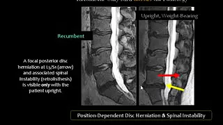 Dr Mamdouh Mahfouz Spinal imaging post operative