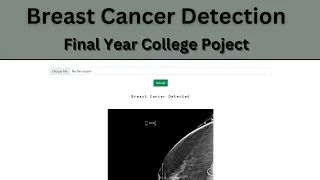 Breast Cancer Detection using Deep Learning | CNN | DenseNet-121 | Final Year College Project | CSE