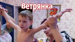 VLOG: У Клима ветрянка, у Вовы тоже?