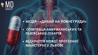 Протезна майстерня та генетична лабораторія | Ситуація з туберкульозом у Львові #MDExpert