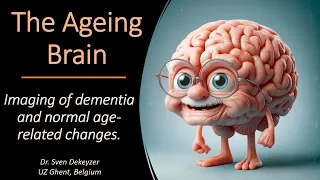 Imaging of dementia and brain ageing (part 1)