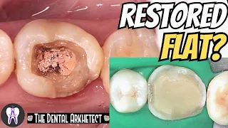 AMAZING Semi-Biomimetic Restoration of A Root Canal Treated Tooth #4k #C50