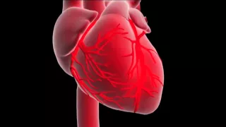 What is a myocardial infarction or heart attack ?