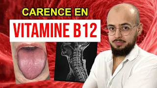 CARENCE en VITAMINE B12 : Les causes et conséquences.