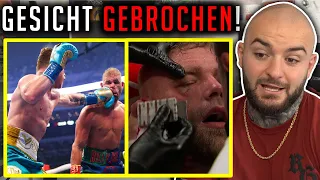 Canelo BRICHT Gegner das GESICHT! Canelo Alvarez vs. Billy Joe Saunders Reaction - RINGLIFE