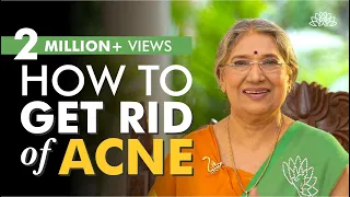 DIY Remedies for acne | Natural Beauty | Dr. Hansaji Yogendra