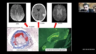 Cardiac Sciences Grand Rounds: Dr. Ashkan Shoamanesh, MD