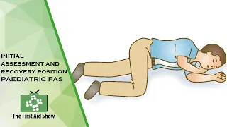 Initial assessment and recovery position PAEDIATRIC FAS