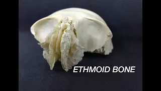 ETHMOID BONE