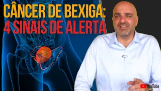 4 Sinais de Alerta e Fatores de Risco para CÂNCER DE BEXIGA