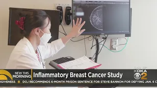 Telltale signs of inflammatory breast cancer